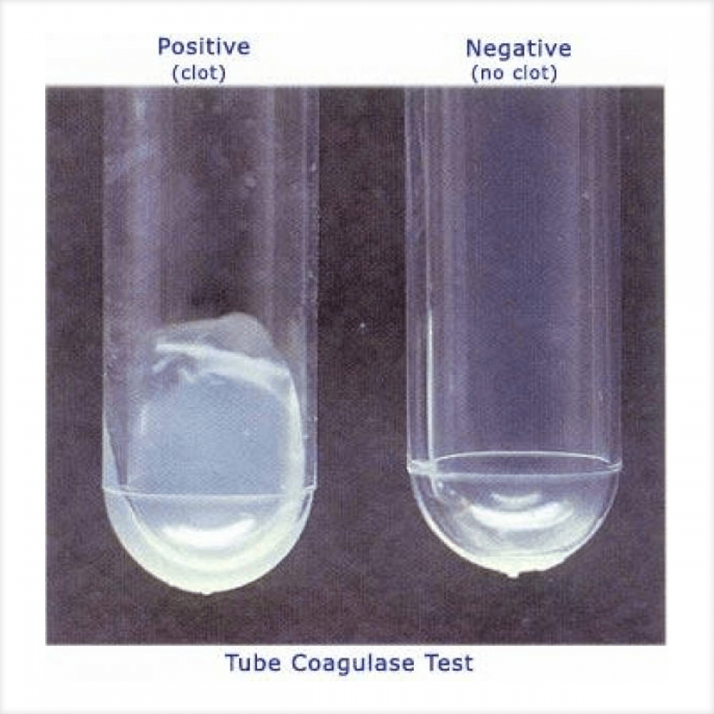 COAGULASA PLASMA DE CONEJO O TEST DE COAGULASA - CMLAB